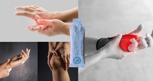 The Integrity of Tendons and Ligaments