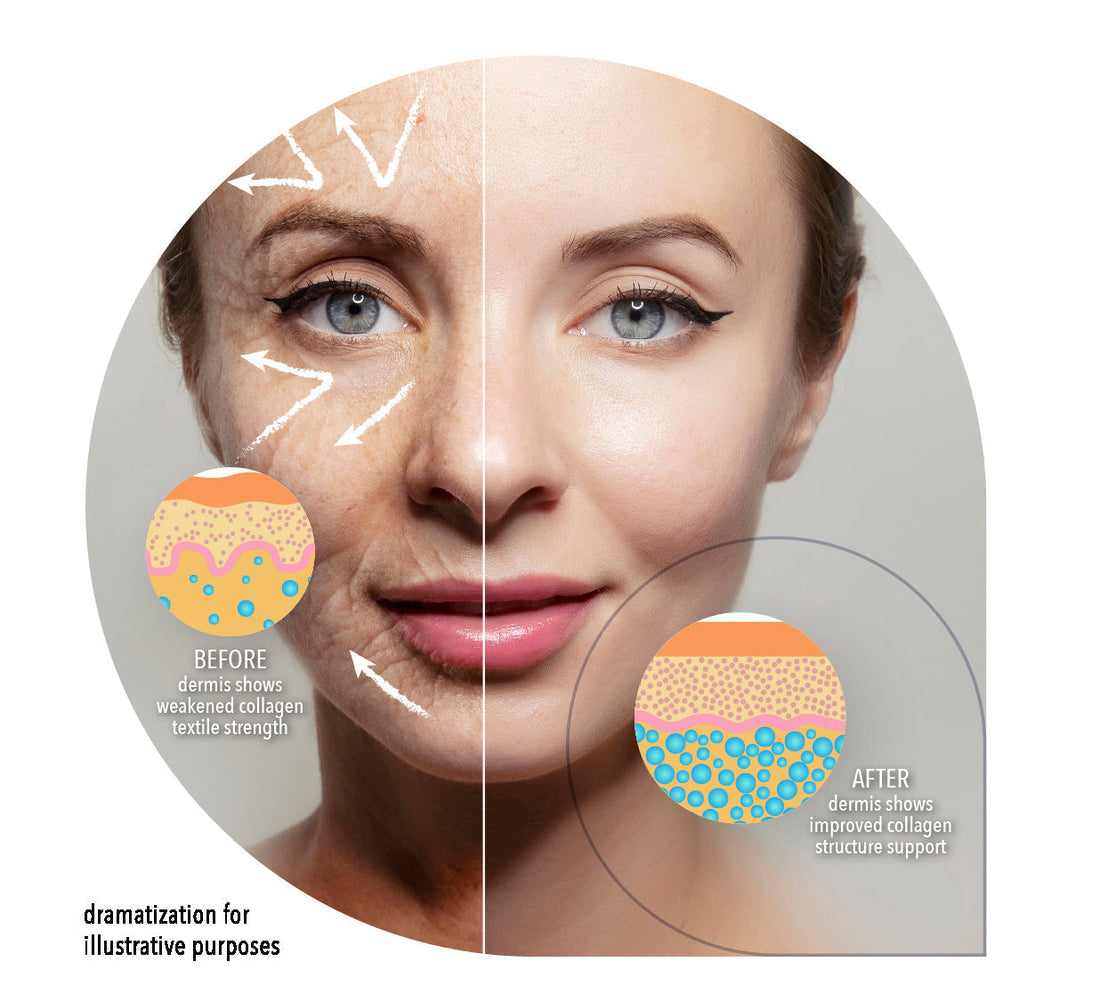 Collagen Supplements for Skin